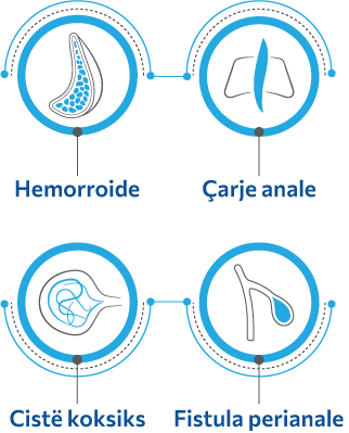 Hemorroide, çarje anale, Cistë koksiks, Fistula perianale